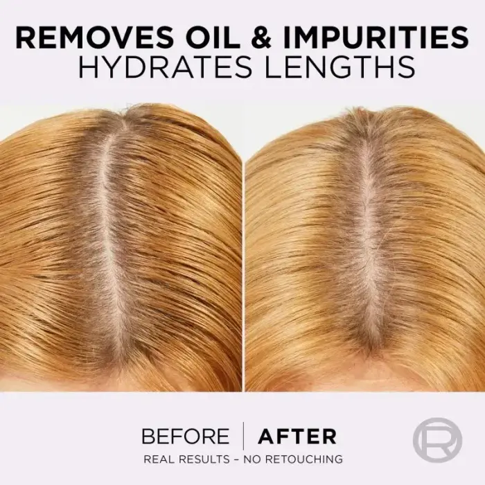 L’oréal Paris Elseve Hyaluron Pure Hair Balm for Oily Scalp and Dry Ends 300 Ml Фото num