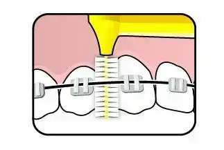 TePe Interstitial Brushes - 6 Pcs Фото num