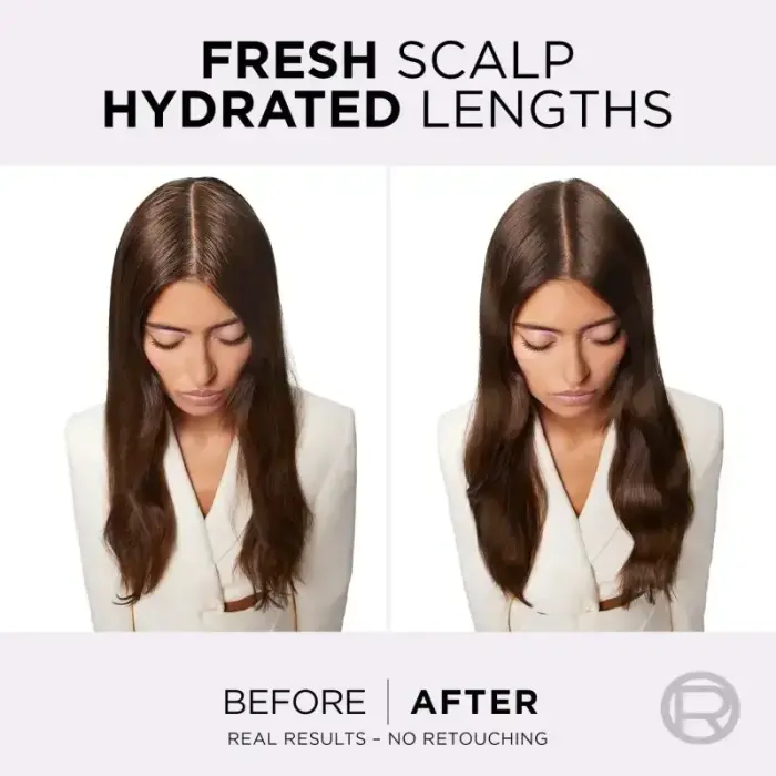 L’oréal Paris Elseve Hyaluron Pure Hair Balm for Oily Scalp and Dry Ends 200 Ml Фото num