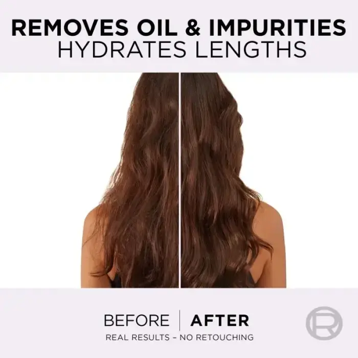 L’oréal Paris Elseve Hyaluron Pure Hair Balm for Oily Scalp and Dry Ends 300 Ml Фото num