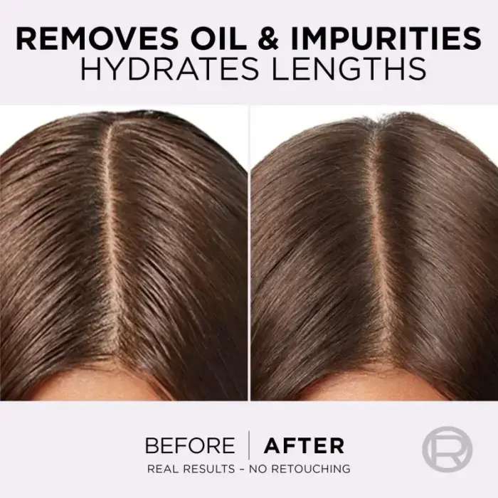 L’oréal Paris Elseve Hyaluron Pure Hair Balm for Oily Scalp and Dry Ends 200 Ml Фото num
