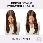 L’oréal Paris Elseve Hyaluron Pure Hair Balm for Oily Scalp and Dry Ends 200 Ml Фото num