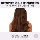 L’oréal Paris Elseve Hyaluron Pure Hair Balm for Oily Scalp and Dry Ends 300 Ml Фото num