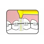 TePe Interstitial Brushes - 6 Pcs Фото num