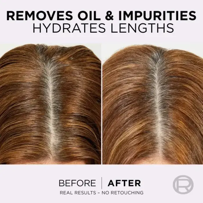 L’oréal Paris Elseve Hyaluron Pure Hair Balm for Oily Scalp and Dry Ends 300 Ml Фото num