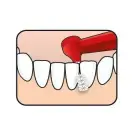 TePe Interstitial Brushes - 6 Pcs Фото num