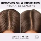 L’oréal Paris Elseve Hyaluron Pure Hair Balm for Oily Scalp and Dry Ends 200 Ml Фото num
